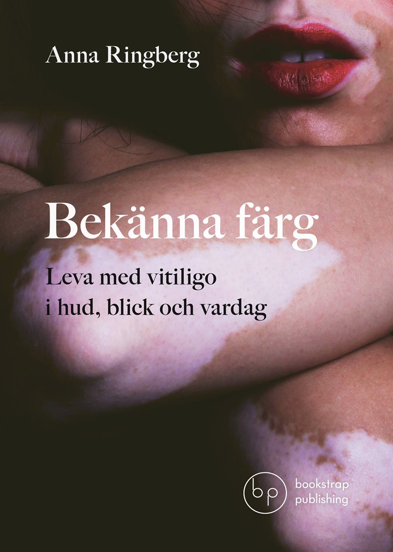 Bekänna färg : leva med vitiligo i hud, blick och vardag